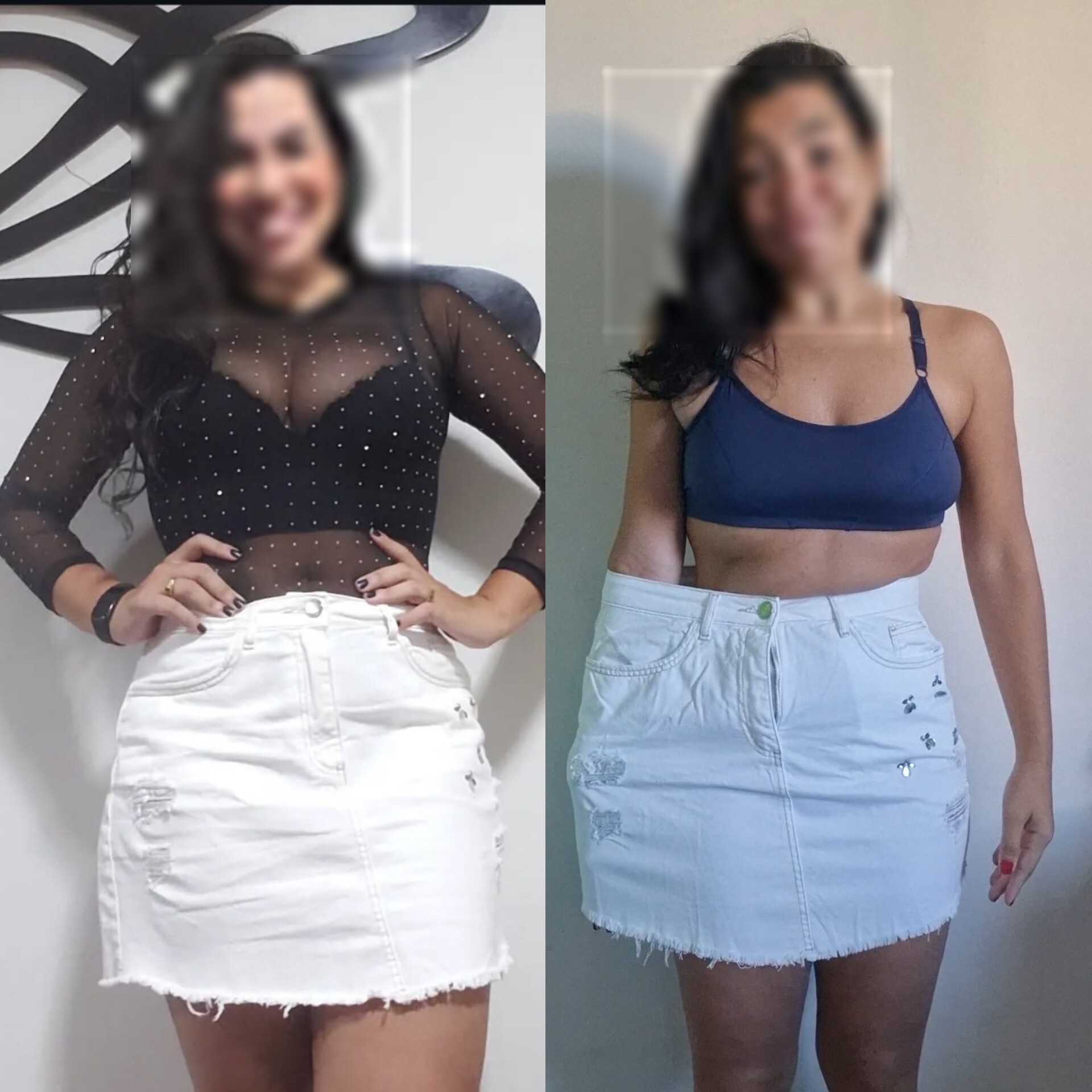Registro comparativo de evolução individual em acompanhamento médico, com identidade preservada.