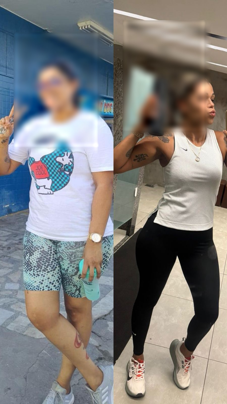 Registro comparativo de evolução individual em acompanhamento médico, com identidade preservada.